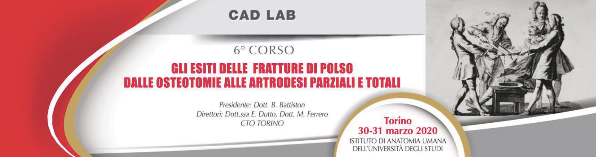 Gli esiti delle fratture di polso dalle osteotomie alle artrodesi parziali e totali